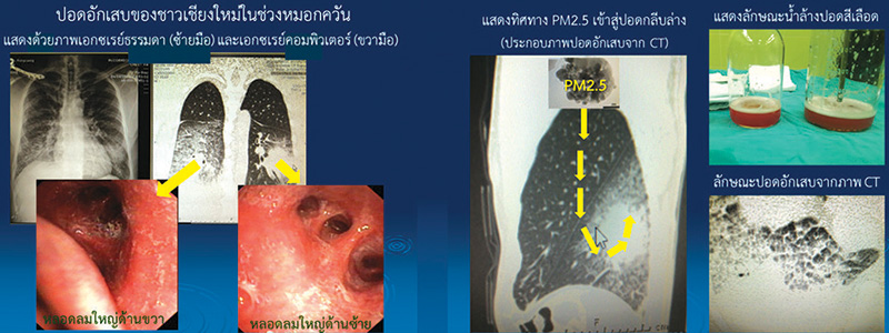 ฝุ่น PM 2.5 ผลกระทบต่อสุขภาพ